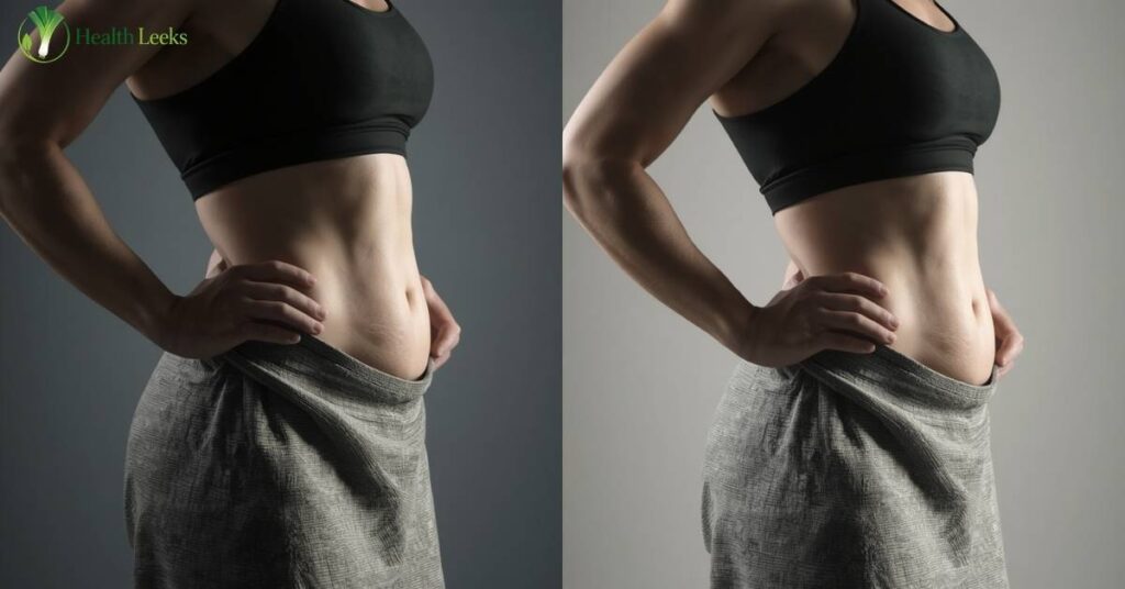 Apron Belly Before and After Exercise