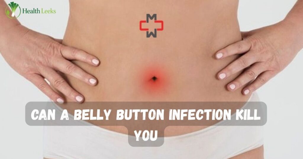 Can a Belly Button Infection Kill You