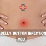Can a Belly Button Infection Kill You