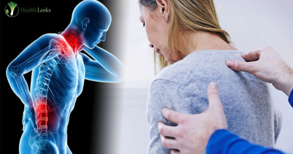 Fibromyalgia