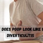 What Does Poop Look Like With Diverticulitis